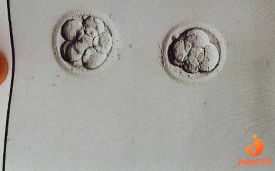 广州代孕公司医院,【广州地下供卵试管哪里有】顺利诞下小棉袄，讲讲我的顺